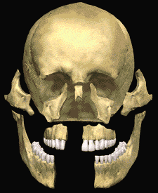 3D Trauma Skeleton